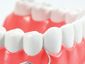 歯周病治療と矯正治療の連携